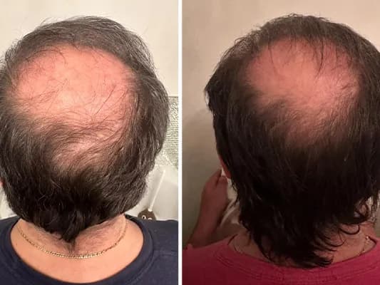 v-tech-system-before-and-after-image-1