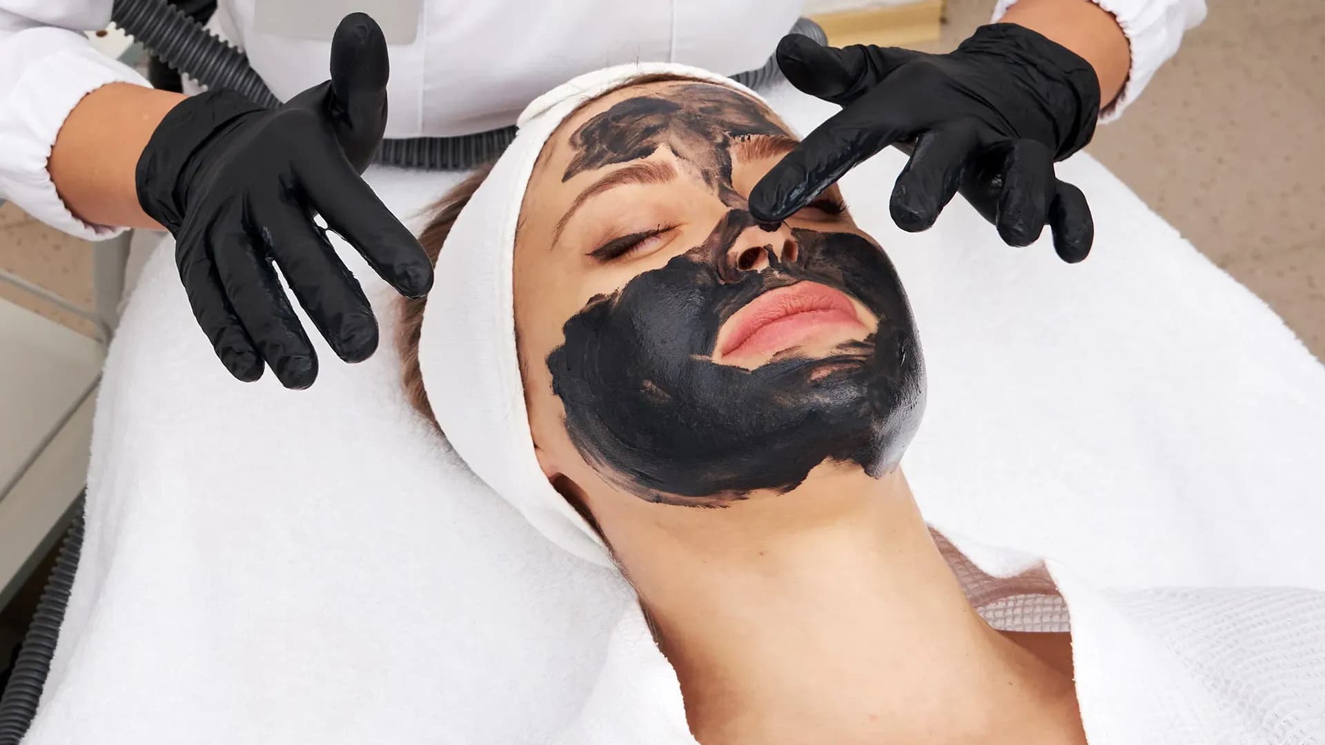 chemical peel